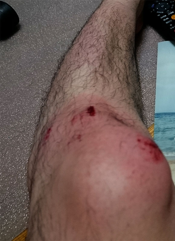 滝川クリステル、自転車で転倒して顔を負傷 「ヘルメットをしていれば 」 – Sirabee