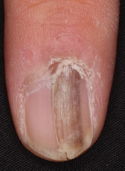 足や爪の病気ＭＹ介護の広場