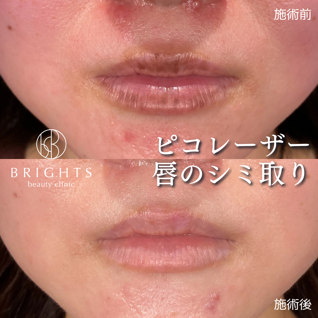 アジソン病 - 長谷川動物病院 土日も診療