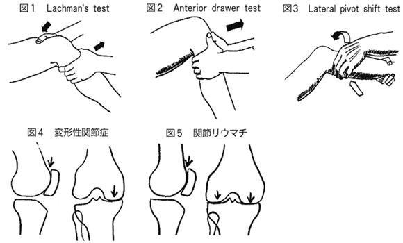 膝崩れについて - 銀座そうぜん鍼灸院 深層筋・自律神経 銀座・築地