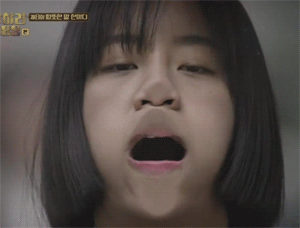 目尻の再手術レポートとダウンタイム経過