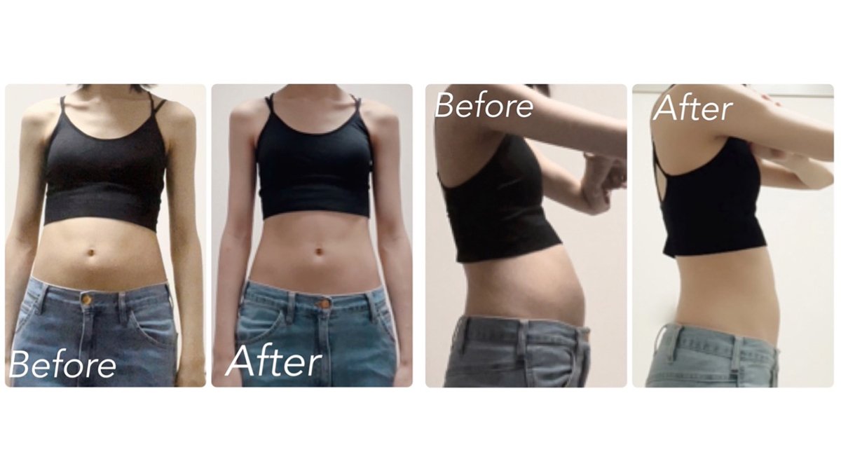 リンパマッサージにいらっしゃったお客様から、 どれくらいの頻度で通ったらいいですか？と いう質問をよく受けます☺️ 1. リラックスや軽いむくみ改善・2~4週間に1回程度のペースが一般的です。定期的 に受けることで血行やリンパの流れが整いやすく