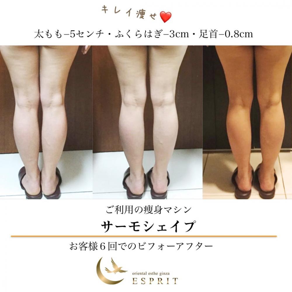 脚やせ エステに関するサロン全身美容痩身 キャビテーション取扱 KIREI SALONE 新宿店などホットペッパービューティ