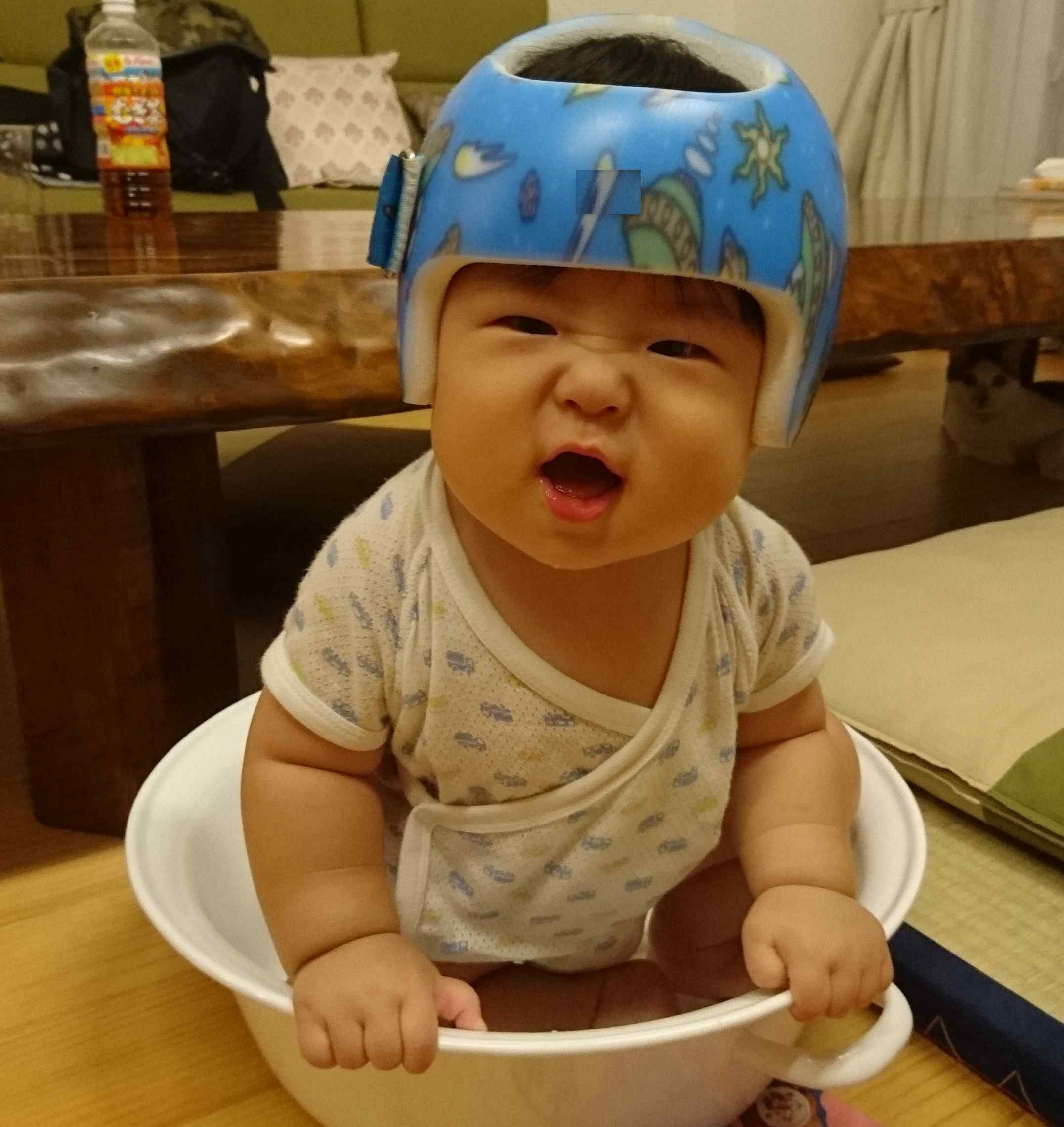 水頭症赤ちゃん ブログTikTok