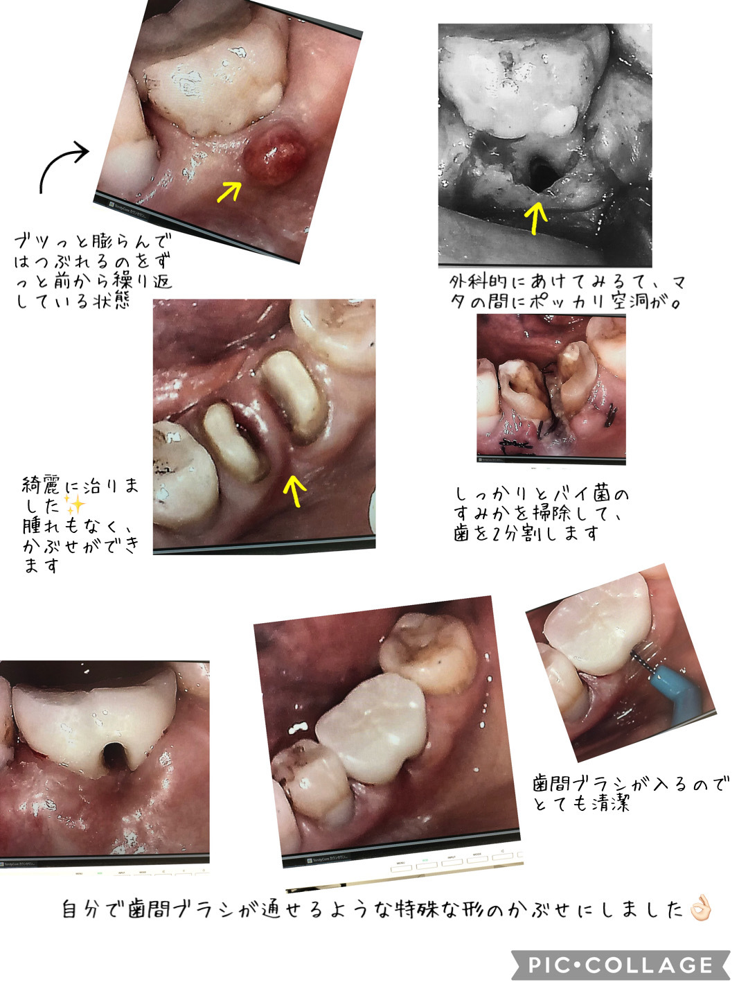 切開排膿について〜不要不急でない状態〜 – 医療法人 双英会 YUKI皮フ科形成外科一宮市時之島の皮膚科、形成外科