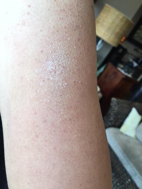 症例限定プラン有二の腕・背中のぶつぶつ・ざらつきに 毛孔性苔癬にダーマペン4 ※麻酔代込広尾プライム皮膚科ホットペッパービューティ