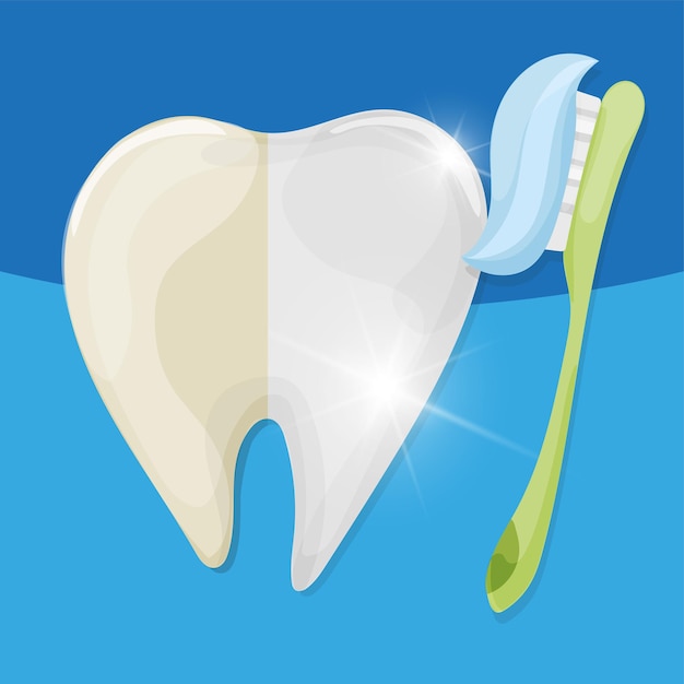 ホワイトニングで歯が白くなってハッピーになっている女性のイラスト - 無料イラストのIMT 商用OK、加工OK