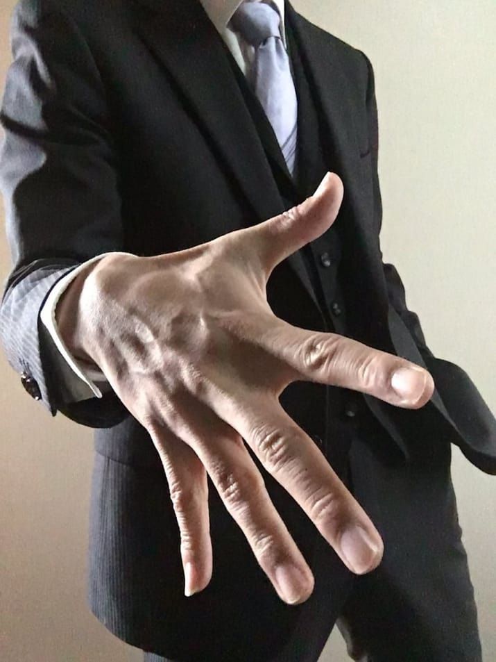 指、手の甲の毛の脱毛✋✨元看護師✖️脱毛士 安芸市脱毛サロンユイット