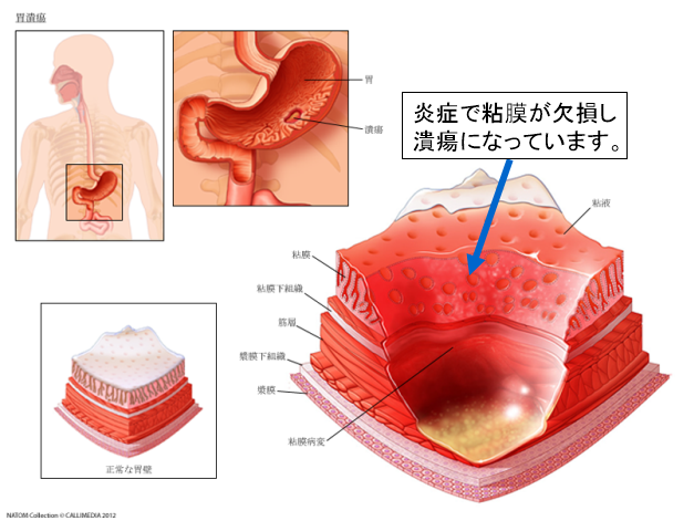 消化器内科について - 浜松市中区の消化器内科・肝臓内科・呼吸器内科・循環器内科 - 栗田内科医院