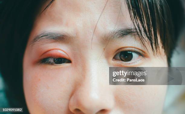 撮影おわり🌼📸 めばちこが出来て朝から眼科に行ったり バタバタな今日でした🥺❗️ ものもらい？めばちこ？笑😂そして、前髪切りたい衝動にかられている ❗️ ❤️おしらせ❤️ 8月23日 日 16:00〜17:00 積水ハウスさんのZOOMオンライントークイベントに出演します