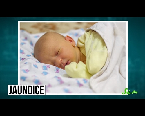 黄疸 治るまでに2ヶ月かかった黄疸の記録 Vlog- YouTube