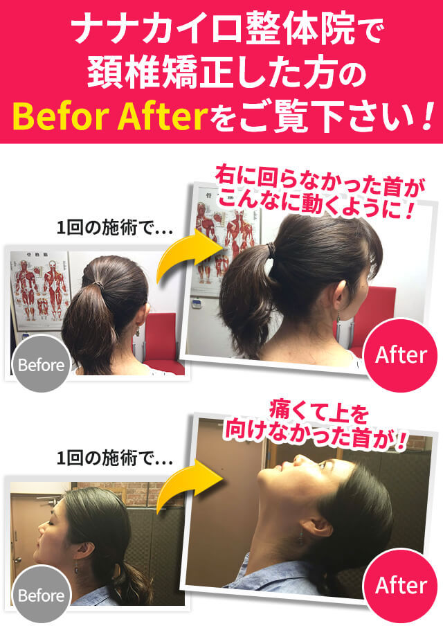 バレリーナのように首を長くする方法簡単にできるストレッチのご紹介マシンピラティス×バレエパーソナル・少人数制プリマ名古屋