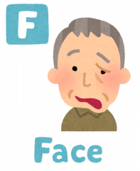 脳梗塞 主にカテーテル治療 対象疾患医療関係者へ近畿大学医学部 脳神経外科