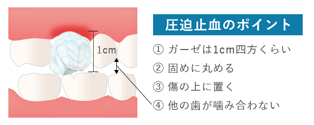 血液専門医が解説 紫斑病の症状・診断・治療上野駅2分 内科・血液内科・糖尿病内科上野御徒町こころみクリニック