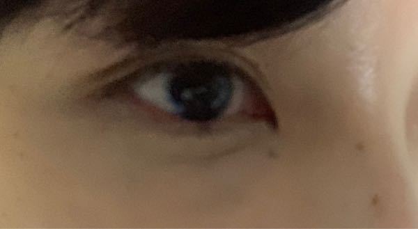 切れ長な美人目に二重術・目頭切開・涙袋・眼瞼下垂の症例写真福岡の美容整形・外科・皮膚科なら聖心美容クリニック福岡院