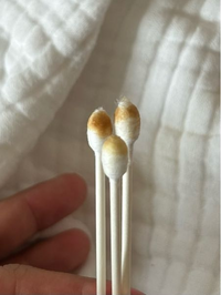 画像 ワキガ体質の耳垢はこれ！軽度から重度のワキガ度チェック臭いラボ