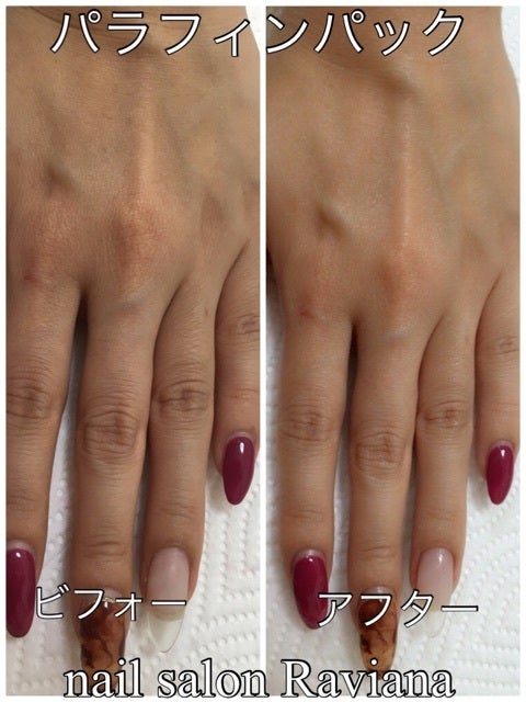 パラフィンパック乾燥しがちな手足をしっかりと潤すスペシャルケアセブンビューティ