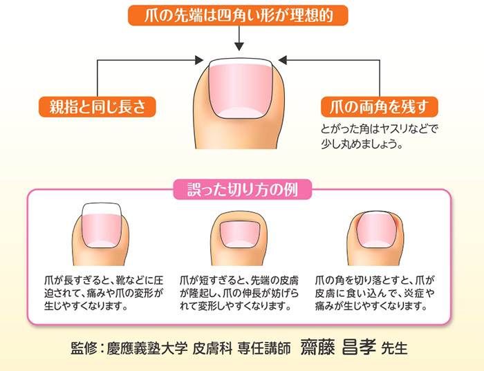 ジェルネイルは爪切りで切ってもいい？注意点や対処法について解説ネイルサロンならFASTNAIL ファストネイル