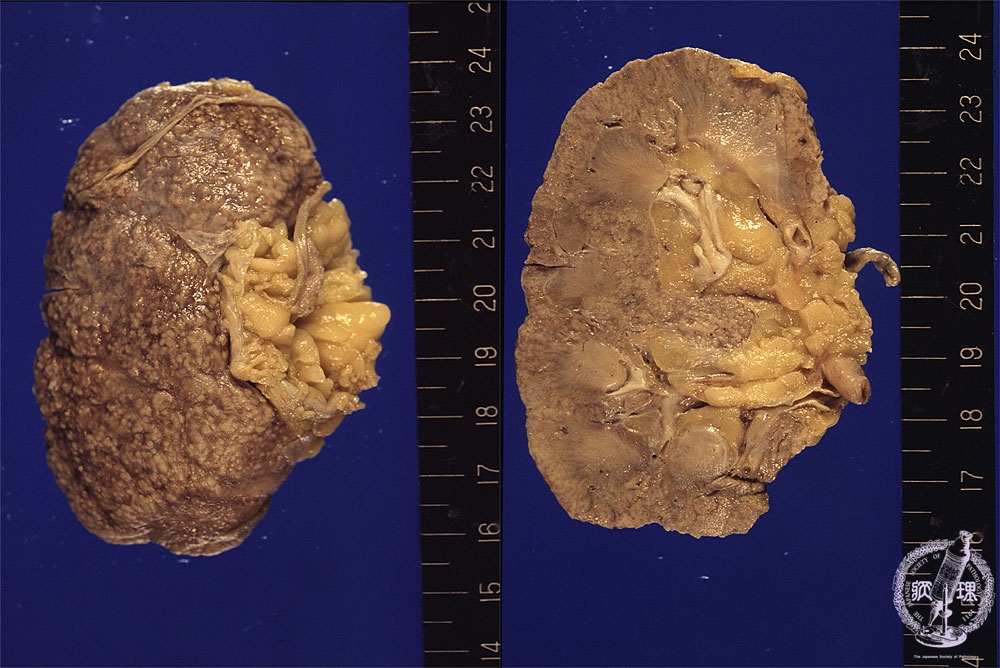 人体模型 腎臓断面図 腎臓 泌尿器 内臓模型 腎臓模型 腎臓の模型 疾患展示模型 人体解剖モデル 腎臓 模型 腎臓 モデル 研究 説明 教材 学習 用インテリア 置物 標本 実験 医療 図鑑 医学qz2333 - メルカリ