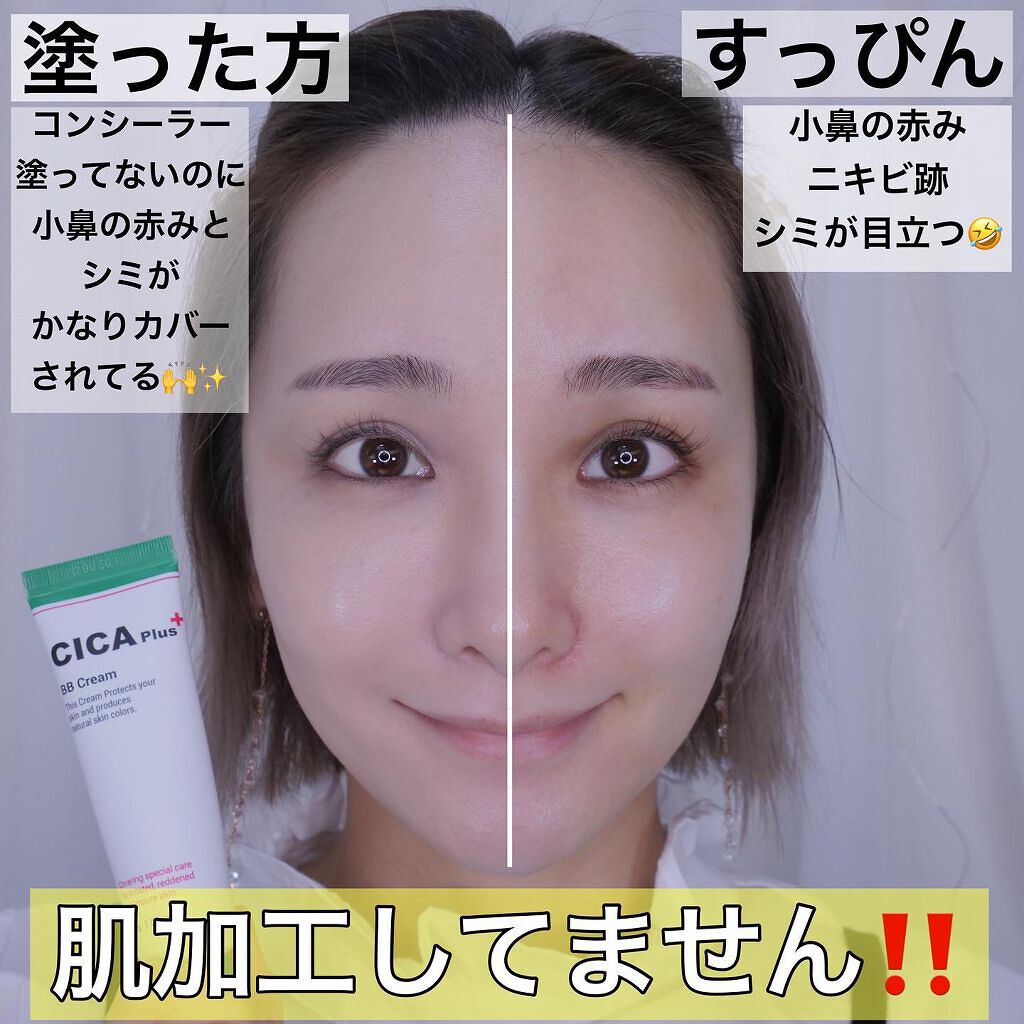 Amazon肝斑リペアクリーム 色素沈着を修復し 美白クリーム 優しいクリーム アンチメラズマ シカ クリーム 薄くする 肝斑 そばかす除去 クリーム 炎症後色素沈着治す20mlYizibuur乳液・クリーム 通販