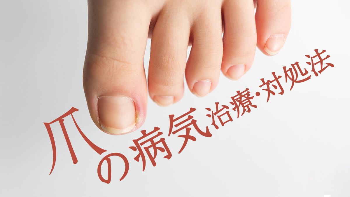 画像あり 爪の病気一覧・主な病気の症例画像皮膚・爪・髪の病気All About