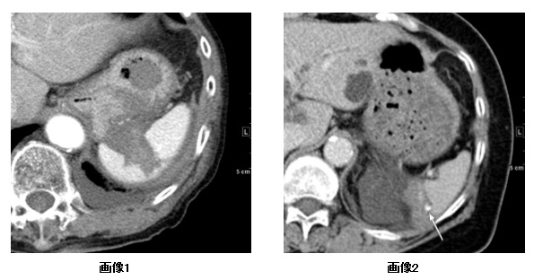 膵・脾疾患臨床画像 36巻9号医書.jp