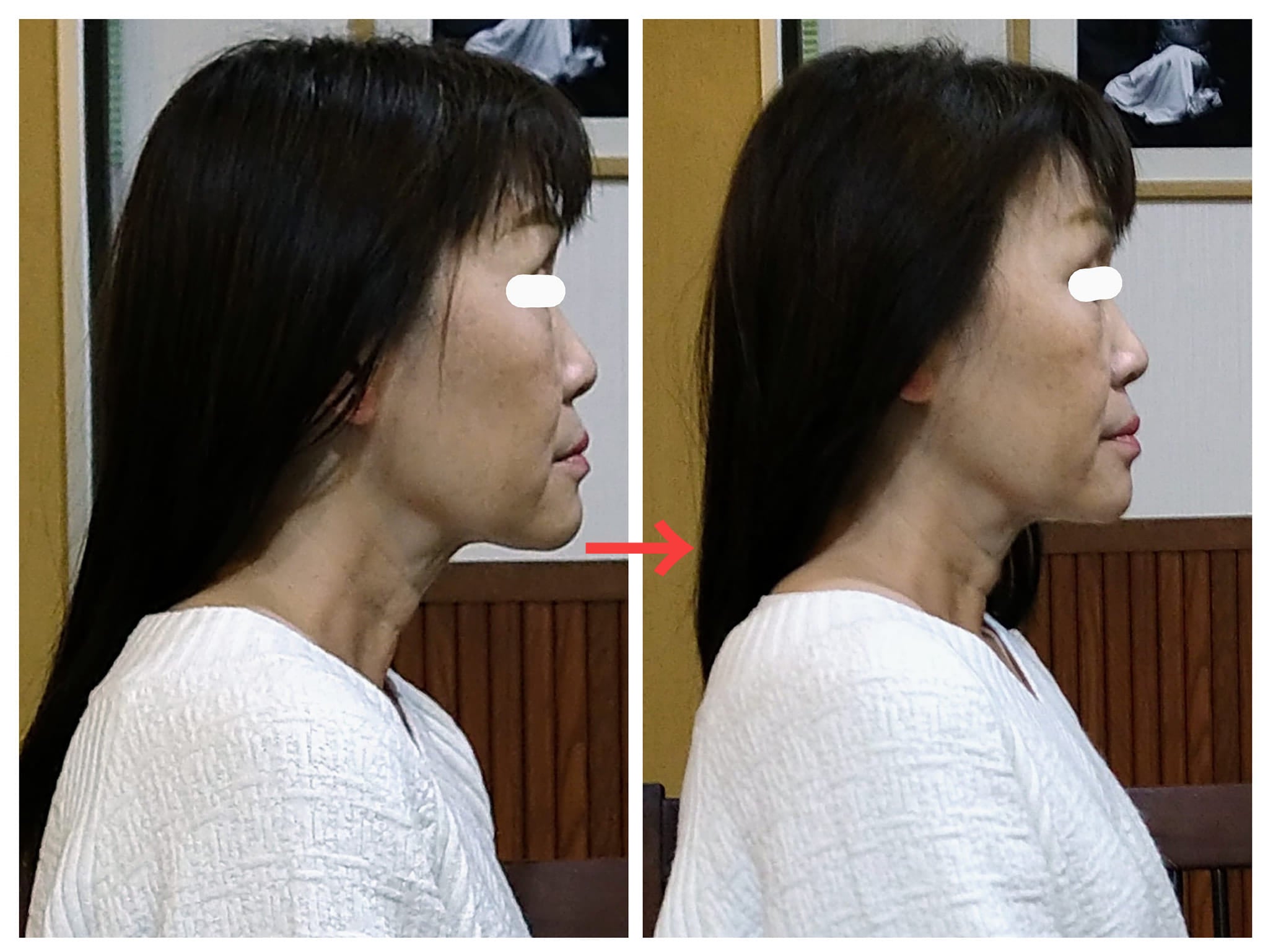 首が前に出てる姿勢はどうやったら自分で治せますか？ - 小顔矯正・整体を東京でお探しならRevision