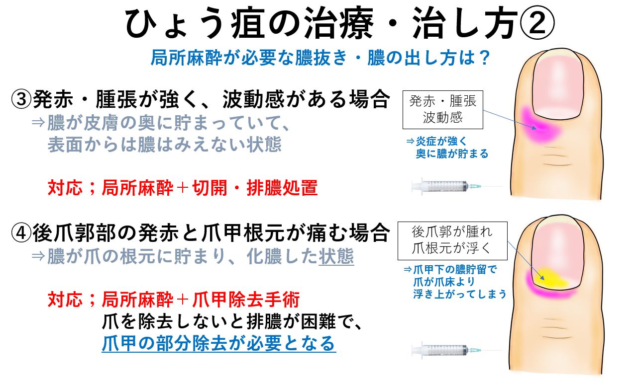 指にバイ菌が入って腫れてる！病院は何科？放置した場合のリスクもMedicalook メディカルック