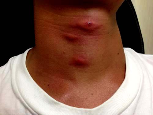 ブユ ブヨ・ブト が発生する原因とは？ブユの習性を知って対策しよう！ - For your LIFE