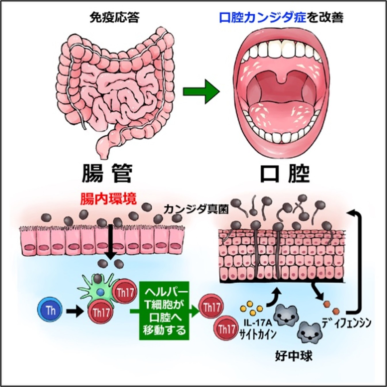 口腔内のカンジダ菌について - けんせい歯科