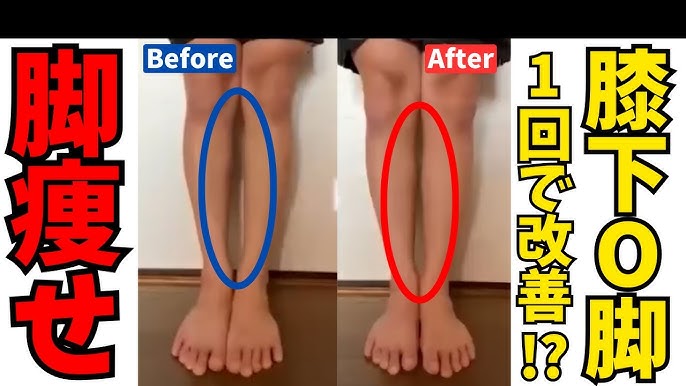 足首から曲がっているo脚の原因と改善策は？セルフチェック方法も紹介くまのみ整骨院グループ