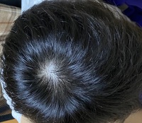 つむじ割れをカバーするセット方法 薄毛に悩む男性の為の美容室ならRELIVE - 薄毛に悩む男性のための完全個室美容室