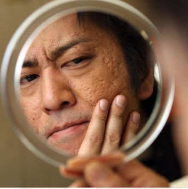 肌が汚いのが治らない ！汚肌タイプやNG習慣、スキンケア方法をご紹介メンズスキンケアに答えを「DISM」