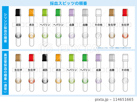 アニメAIRの見る順番は？全5作品の視聴順序と配信情報を徹底解説ゼンシーア