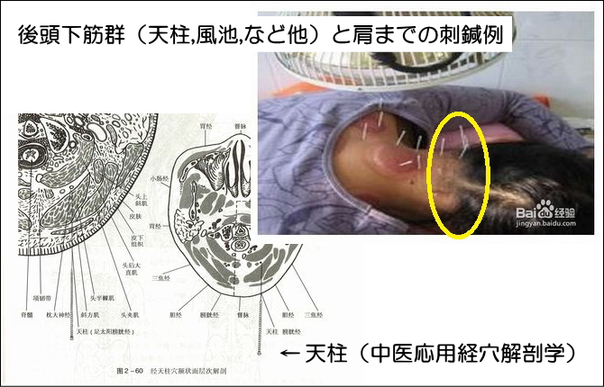 保存版 肩こり解消！セルフケアで押すべきツボ７選 堺市・富田林の整骨院グループたな骨グループ