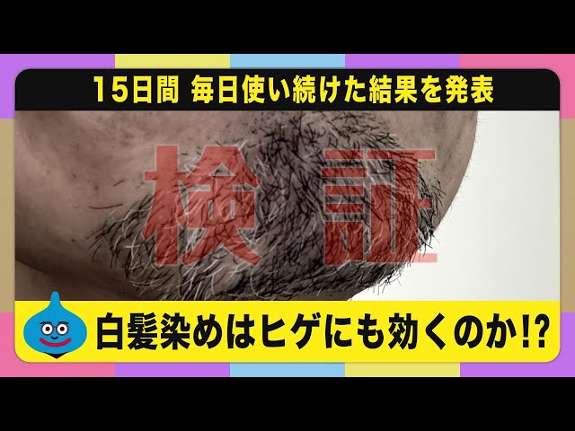 楽天市場初回特典 薬用ボディソーププレゼント 白髪染め シャンプー スカルプケア ヘアカラー 染髪 DiNOMEN ノアール リペア 2本セット白髪隠し スカルプケア 髪染め 毛染 頭皮ケア 育毛シャンプー セルフケア ヘアマニキュア ヘアケア 黒髪 ひげ染 父の日 △特