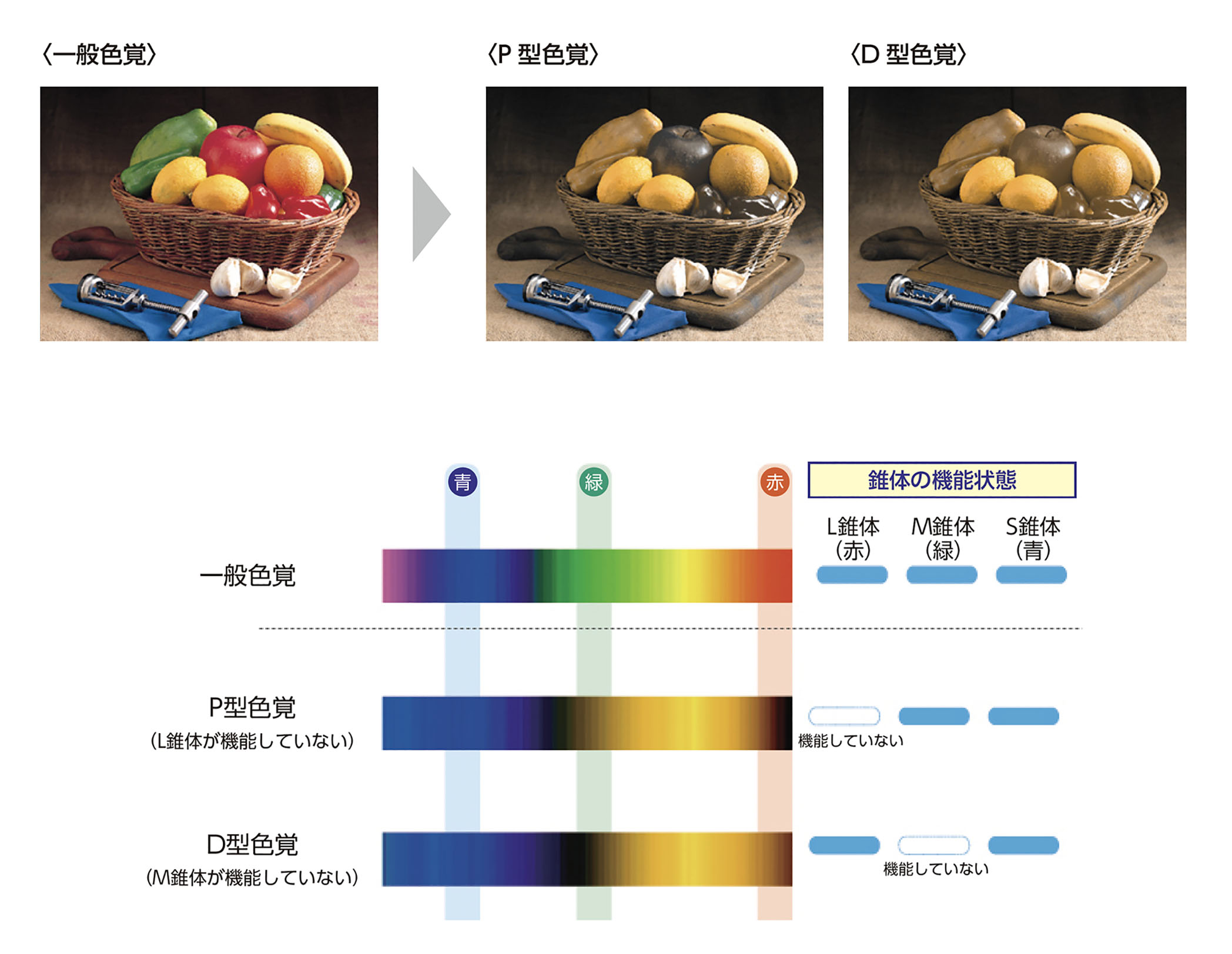 医療のあり方・遺伝子・倫理・治療 - 先天色覚異常 当事者のホンネ