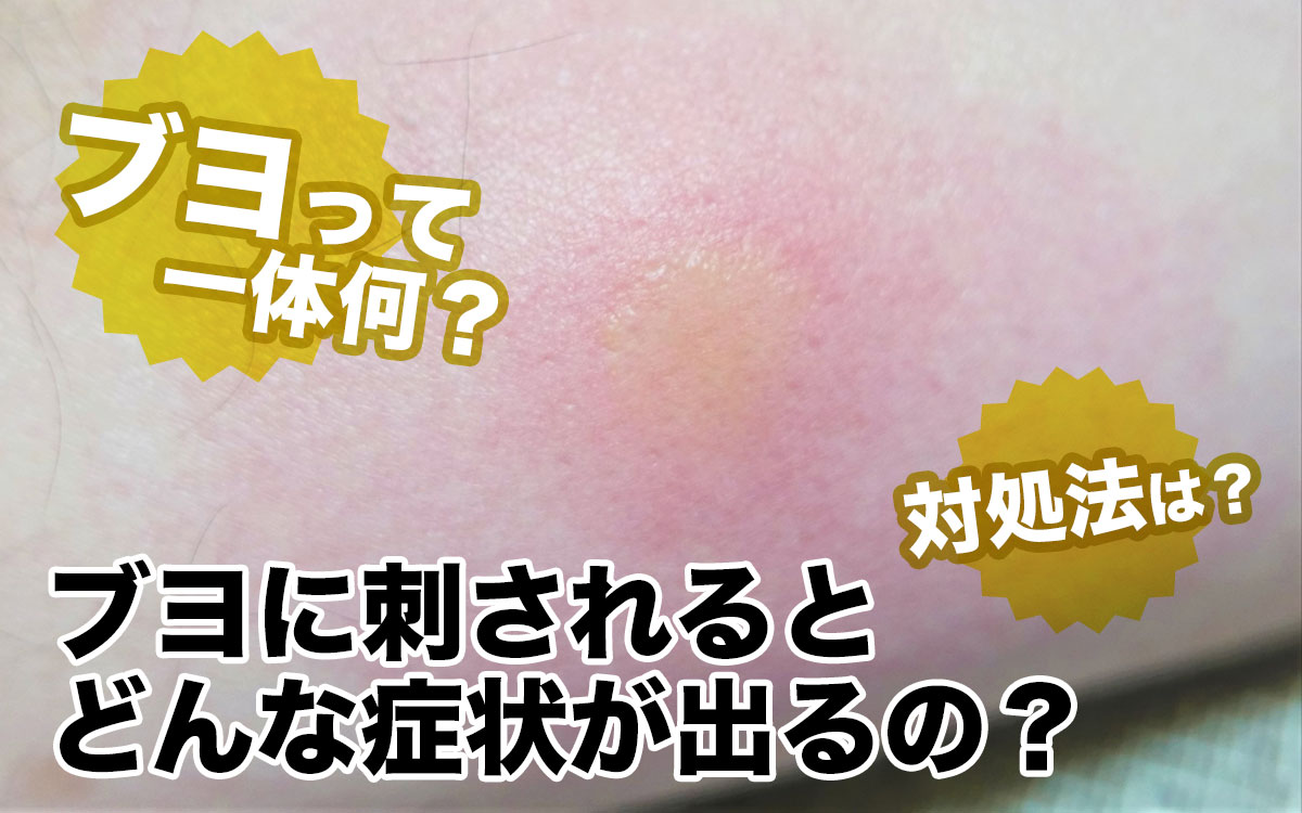 虫と侮る事なかれ、病院へ〜ウッチィ オフィシャルブログ「ウッチィの徒然blog」Powered by Ameba