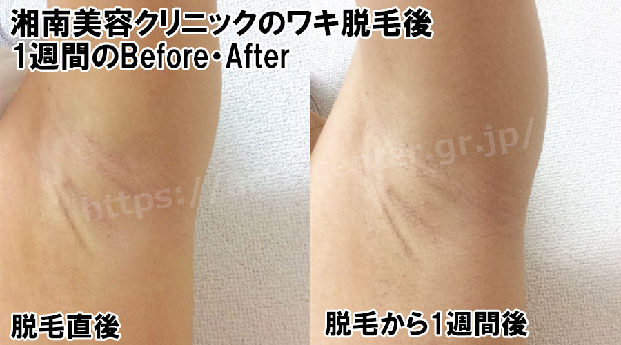 湘南美容外科 予約の取り方を徹底解説 予約が取りにくいって本当？ - なすにんブログ