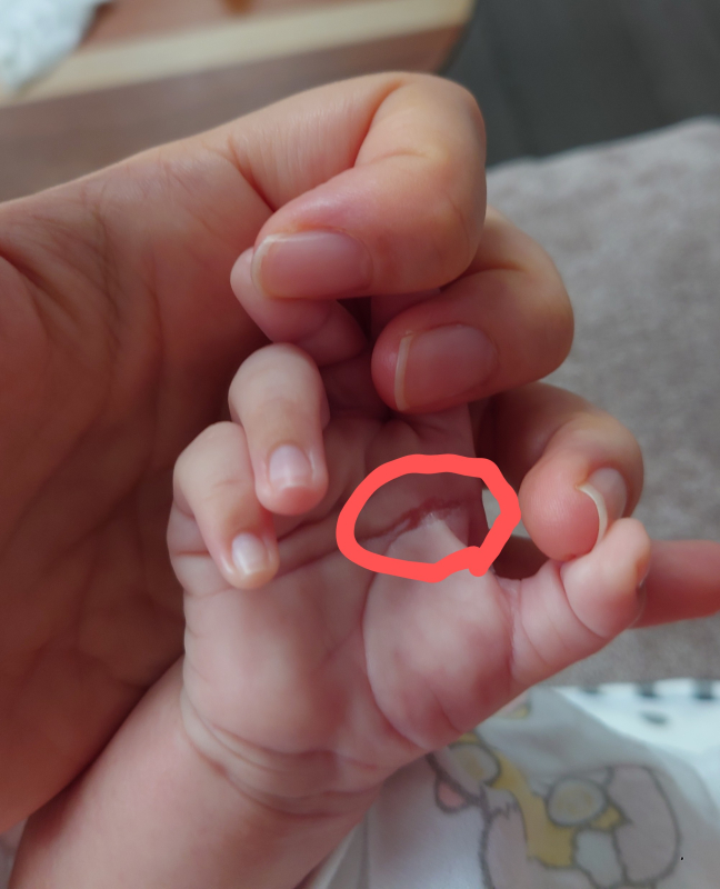 薬ばかりに頼らずアトピー対策！赤ちゃんのアトピーには無添加固形石鹼で肌質改善 – HOLO