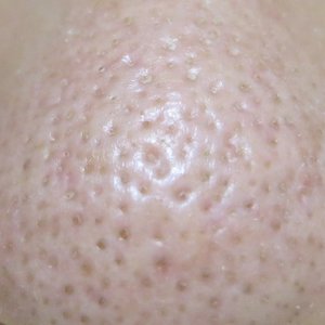 角質培養 成功: 角質培養 成功へと導くサッポー化粧品 口コミレビュ