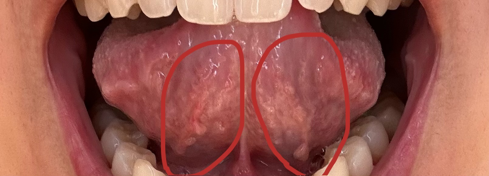 特徴的なたっぷりとした袖、ひだ状にボーダーを表現したロングスリーブ。柔らかく肌触りのよい生地から生まれる立体感や色使いなど、一枚で主役級のアイテムです。 frill pulloverjonnlynxWOOL LINEN SUITING TUCKED SLACKSfumikauchidafumika_uchida
