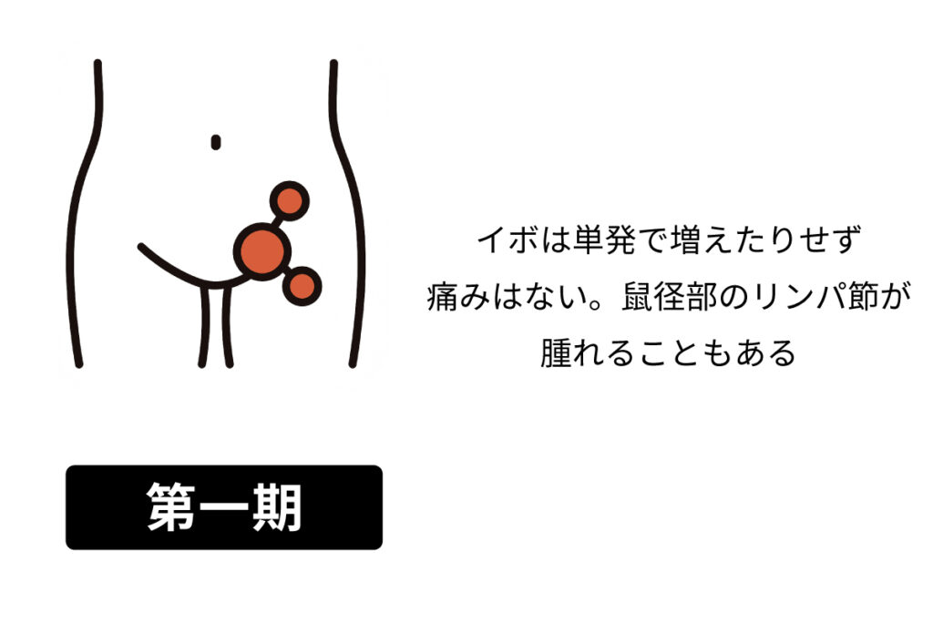 梅毒についてあおぞら研究所