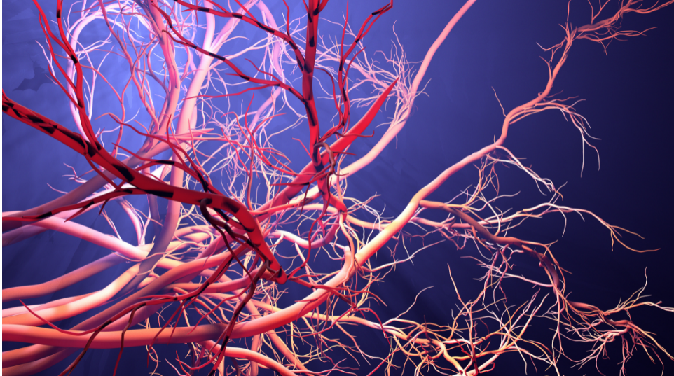 脳梗塞予防の新常識！ルイボスティーが血管を守るメカニズムを徹底解剖再生医療×リハビリ・脳卒中・脊髄損傷