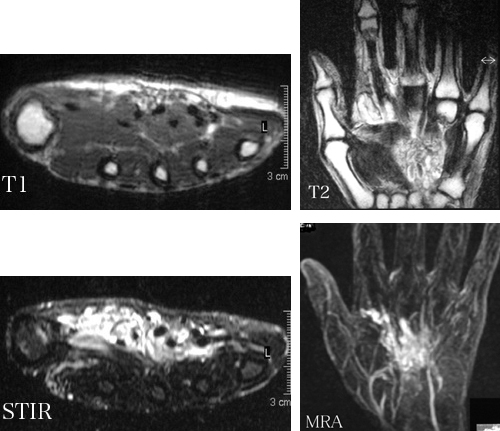 心筋－バーチャルラボラトリ