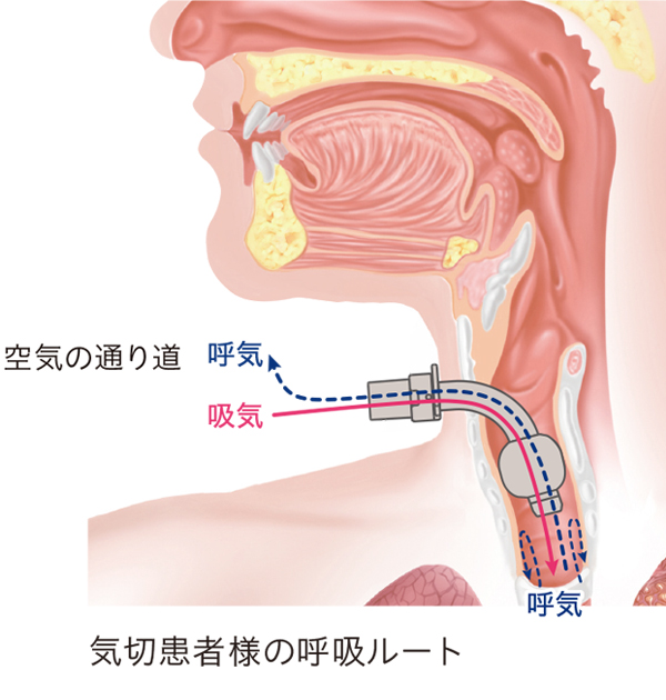 ⚠️注意⚠️気管支の左右差 表 について 傾斜 右→緩やか、左→急 となっておりますが、視点により緩急が異なるため以下に訂正させてください🙇🏻‍♂️ ○右気管支→垂直 ○左気管支→水平 わかり辛い表現になりましたこと、 誠に申し訳ございません🙇🏻‍♂️ーーーー