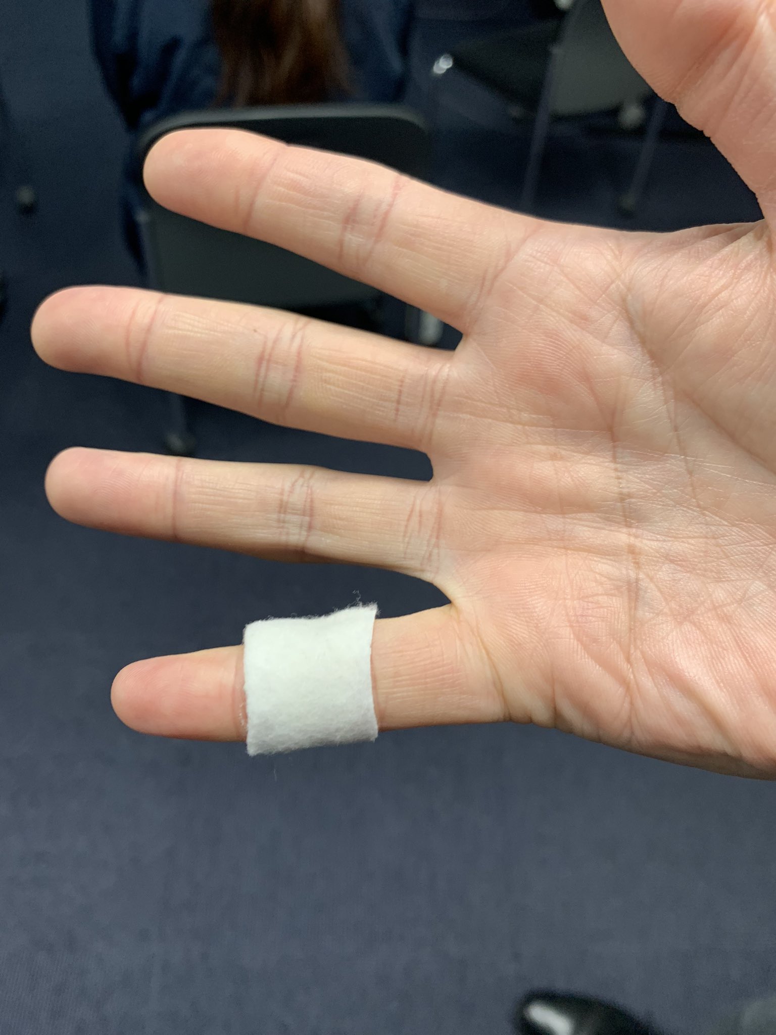 猫缶のふたで小指をザックリ！！！ - ブログ：ハワイオブジュンコ～ハワイアンジュエリー 結婚指輪