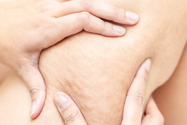 1日1回 セルライト除去 『気になる二の腕の「振袖」をなくす方法』 北千住 接骨 整骨院- YouTube