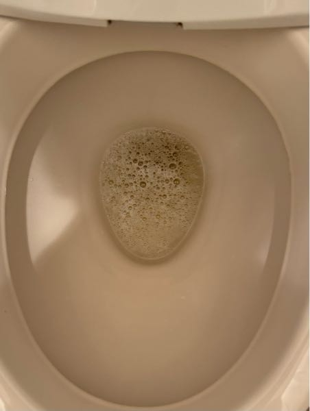 糖尿病患者の尿の特徴は？自分で糖尿病か確認する方法ドクターズチョイス健康情報集