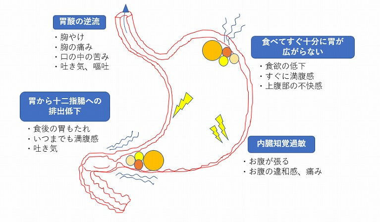 腹部膨満感、腹鳴よく見られる大人の病気 - みやけ内科・循環器科 家庭の医学
